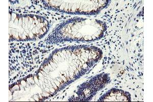 Immunohistochemical staining of paraffin-embedded Human colon tissue using anti-ACBD3 mouse monoclonal antibody. (ACBD3 anticorps)