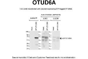 WB Suggested Anti-OTUD6A Antibody Titration: 2 ug/mlPositive Control: Human HeLa Cell line (OTUD6A anticorps  (N-Term))