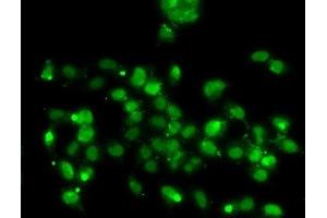 Immunofluorescence analysis of A-549 cells using WBSCR22 Polyclonal Antibody (WBSCR22 anticorps)