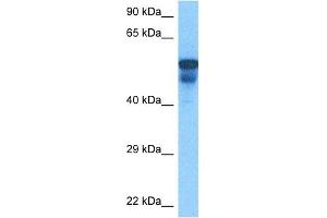 Host:  Rabbit  Target Name:  PORCN  Sample Tissue:  Human Lung Tumor  Antibody Dilution:  1ug/ml
