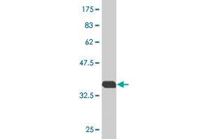 Western Blot detection against Immunogen (36. (RAB7B anticorps  (AA 100-199))