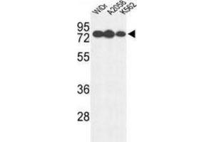 Western Blotting (WB) image for anti-Glucuronidase, beta (GUSB) antibody (ABIN3004140)
