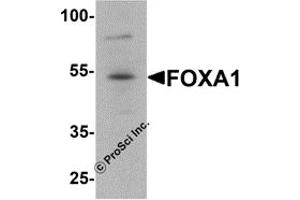 Western Blotting (WB) image for anti-Forkhead Box A1 (FOXA1) antibody (ABIN1077450) (FOXA1 anticorps)