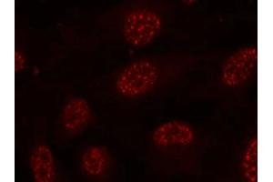 Immunofluorescence staining of methanol-fixed Hela cells using MAPKAPK-2(Phospho-Thr334) Antibody.