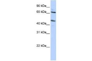 Western Blotting (WB) image for anti-Solute Carrier Family 26 (Sulfate Transporter), Member 10 (SLC26A10) antibody (ABIN2458442) (SLC26A10 anticorps)