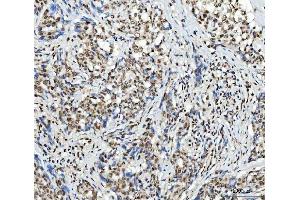 IHC analysis of SCML1 using anti-SCML1 antibody (ABIN7602479). (SCML1 anticorps  (AA 8-322))