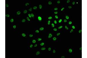 Immunofluorescence staining of Hela cells with ABIN7145150 at 1:67, counter-stained with DAPI.