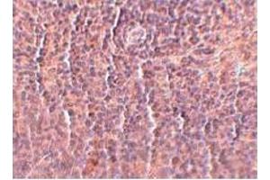 anti-ORAI Calcium Release-Activated Calcium Modulator 3 (ORAI3) (C-Term) antibody