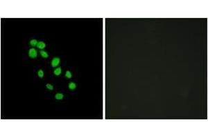 Immunofluorescence analysis of HepG2 cells, using IRX2 Antibody. (IRX2 anticorps  (AA 231-280))