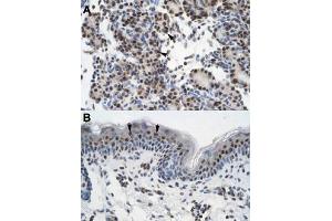 Immunohistochemical staining (Formalin-fixed paraffin-embedded sections) of human pancreas (A) and human skin (B) with GTF2I polyclonal antibody  at 4-8 ug/mL working concentration. (GTF2I anticorps  (N-Term))