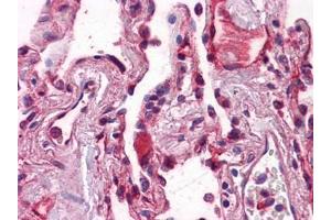 Immunohistochemistry (IHC) image for anti-Cadherin 1, Type 1, E-Cadherin (Epithelial) (CDH1) (AA 381-481) antibody (ABIN614587)