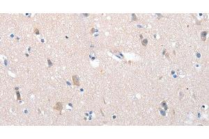 Immunohistochemistry of paraffin-embedded Human brain using YWHAG Polyclonal Antibody at dilution of 1:100