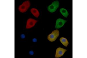CXCR4 Mouse Monoclonal Antibody staining Hela cells by IF/ICC. (CXCR4 anticorps)