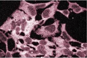 Immunofluorescence staining of HeLa cells. (BCAT1 anticorps  (AA 213-335))