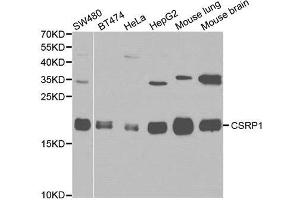 Western blot analysis of various cell lines, using CSRP1 antibody. (CSRP1 anticorps)