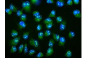 IF analysis of Galectin 2/LGALS2 using anti-Galectin 2/LGALS2 antibody (ABIN7598979). (Galectin 2 anticorps  (AA 1-132))