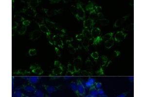 Immunofluorescence analysis of NIH-3T3 cells using GLUD1 Polyclonal Antibody at dilution of 1:100.