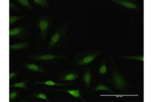 Immunofluorescence of purified MaxPab antibody to BCL2L1 on HeLa cell.