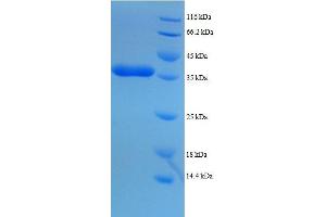 Dynein, Axonemal, Light Chain 1 (DNAL1) (AA 1-89), (full length) protein (GST tag)