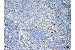 IHC analysis of IL17 using anti-IL17 antibody .