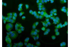 IF analysis of NSF using anti-NSF antibody (ABIN7601630).