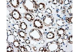 Immunohistochemical staining of paraffin-embedded Kidney tissue using anti-FAHD2Amouse monoclonal antibody. (FAHD2A anticorps)