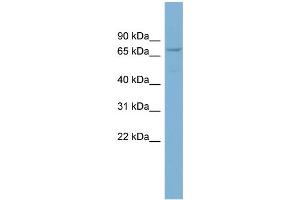 WB Suggested Anti-CNOT4 Antibody Titration: 0. (CNOT4 anticorps  (Middle Region))