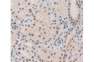 Used in DAB staining on fromalin fixed paraffin- embedded Kidney tissue