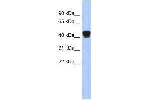 WB Suggested Anti-TXNDC4 Antibody Titration: 0. (ERP44 anticorps  (Middle Region))