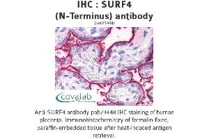 Image no. 2 for anti-Surfeit 4 (SURF4) (N-Term) antibody (ABIN1739779)