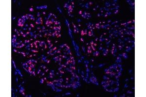 IF analysis of SMC6 using anti-SMC6 antibody (ABIN7601864).