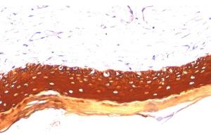 Formalin-fixed, paraffin-embedded human Skin stained with Cytokeratin, LMW Monoclonal Antibody (KRTL/1077). (Keratin 77 anticorps)