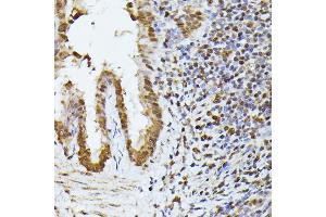Immunohistochemistry of paraffin-embedded rat lung using HNRNPL antibody (ABIN6128048, ABIN6141915, ABIN6141917 and ABIN6216076) at dilution of 1:100 (40x lens).