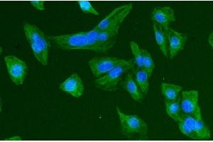 IF analysis of Tubulin beta using anti-Tubulin beta antibody (ABIN7602744).