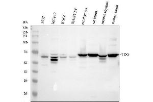 Western blot analysis of TDG using anti-TDG antibody (ABIN7600107).