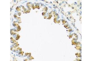 Immunohistochemistry of paraffin-embedded Mouse lung using S100A7 Polyclonal Antibody at dilution of 1:100 (40x lens). (S100A7 anticorps)