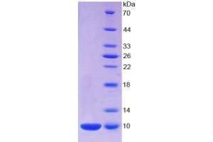 SDS-PAGE analysis of Human S100A7 Protein. (S100A7 Protéine)