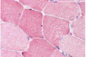Human Skeletal Muscle (formalin-fixed, paraffin-embedded) stained with BRCC3 antibody ABIN213911 at 5 ug/ml followed by biotinylated goat anti-rabbit IgG secondary antibody ABIN481713, alkaline phosphatase-streptavidin and chromogen. (BRCC3 anticorps  (N-Term))