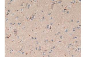 IHC-P analysis of Human Brain Tissue, with DAB staining. (Coronin 1a anticorps  (AA 7-204))