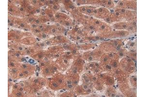 Detection of PYGL in Human Liver Tissue using Polyclonal Antibody to Glycogen Phosphorylase, Liver (PYGL)