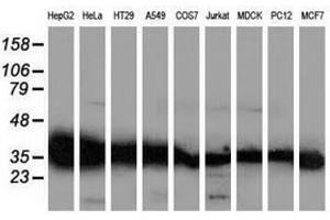 Image no. 11 for anti-UDP-Galactose-4-Epimerase (GALE) antibody (ABIN1498366) (GALE anticorps)