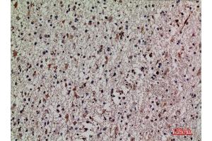 Immunohistochemistry (IHC) analysis of paraffin-embedded Human Brain, antibody was diluted at 1:100.