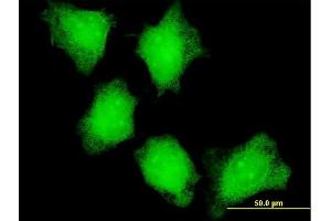 Immunofluorescence of monoclonal antibody to CAMK2A on HeLa cell.