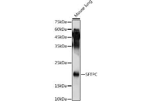 Western blot analysis of extracts of Mouse lung, using SFTPC antibody (ABIN3015597, ABIN3015598, ABIN3015599, ABIN1682683 and ABIN6218961) at 1:1000 dilution.