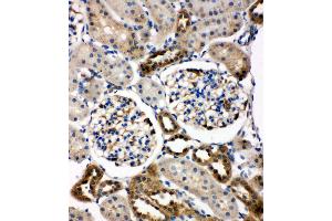 Anti-WISP1 antibody, IHC(P) IHC(P): Rat Kidney Tissue