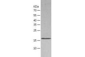 Western Blotting (WB) image for ASF1 Anti-Silencing Function 1 Homolog B (ASF1B) (AA 1-202) protein (His-IF2DI Tag) (ABIN7121905)