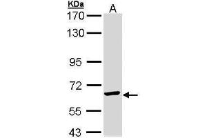 WB Image Sample (30 ug of whole cell lysate) A: Molt-4 , 7.