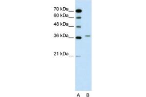 Western Blotting (WB) image for anti-Aminolevulinate Dehydratase (ALAD) antibody (ABIN2462445)