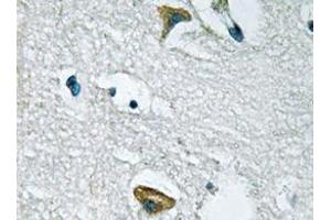 Immunohistochemistry analyzes of JAK3 antibody in paraffin-embedded human brain tissue. (JAK3 anticorps)