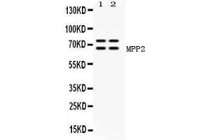 Western blot analysis of MPP2 expression in rat brain extract ( Lane 1) and mouse brain extract ( Lane 2). (MPP2 anticorps  (AA 387-576))